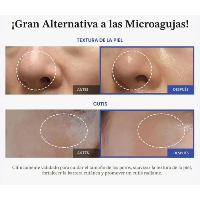 MEDICUBE ONE DAY EXOSOME SHOT PORE SERUM 2000 30ml